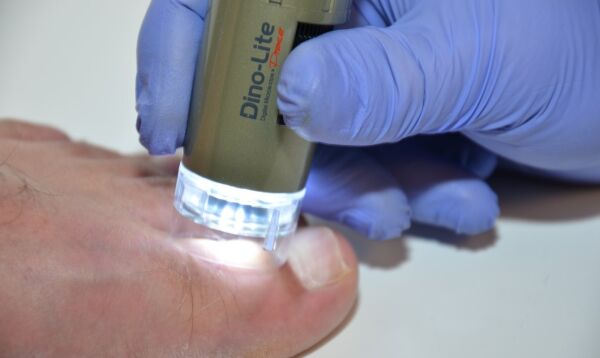 MEDL4FW Dino-Lite Podoscope