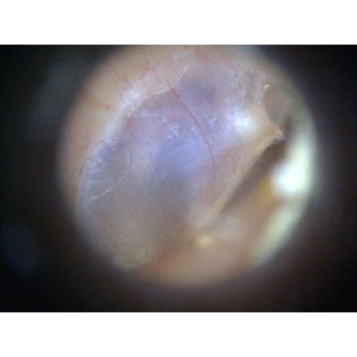 MEDLW3E Dino-Lite EarScope Basic Wireless