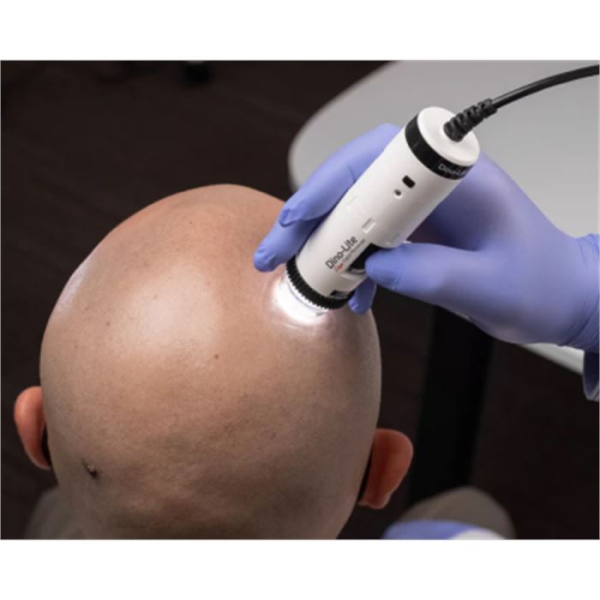 MEDLW4-HM Dino-Lite TrichoScope Polarizer Wireless