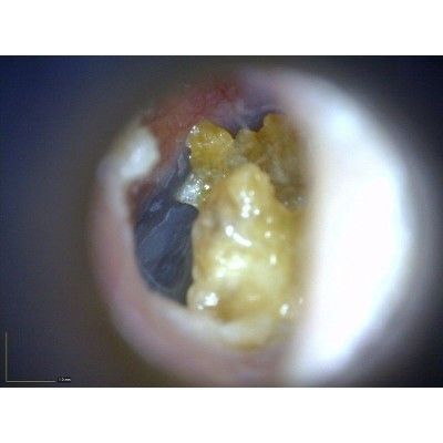 MEDLW4E Dino-Lite EarScope Pro Wireless