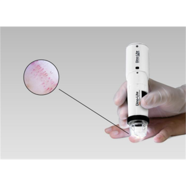 MEDLW4N5 PRO Dino-Lite CapillaryScope 500 Pro Wireless