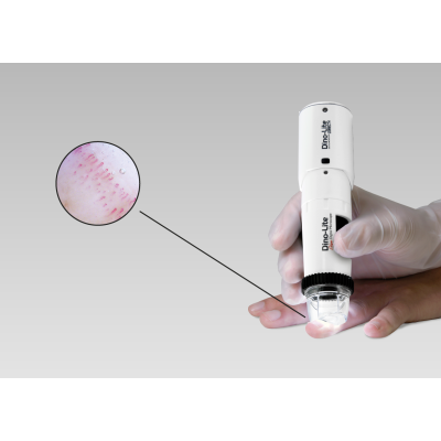 MEDLW4N5 PRO Dino-Lite CapillaryScope 500 Pro Wireless