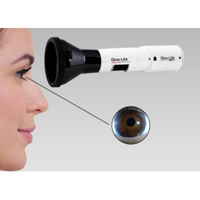 MEDLW4R Dino-Lite IriScope Wireless